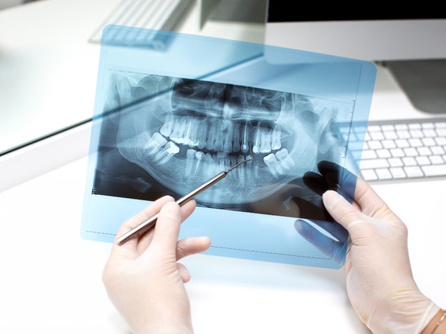 Dr. Vlad Talos - Endodontia